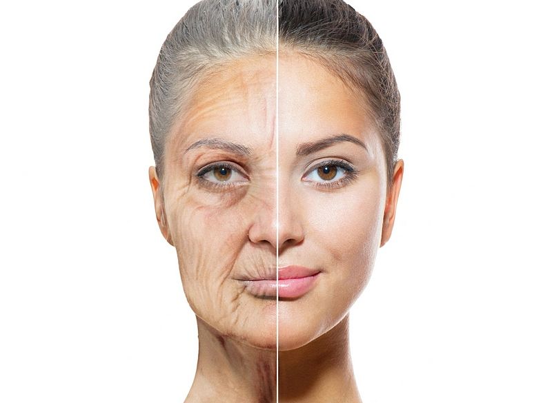 biorevitalizasiya